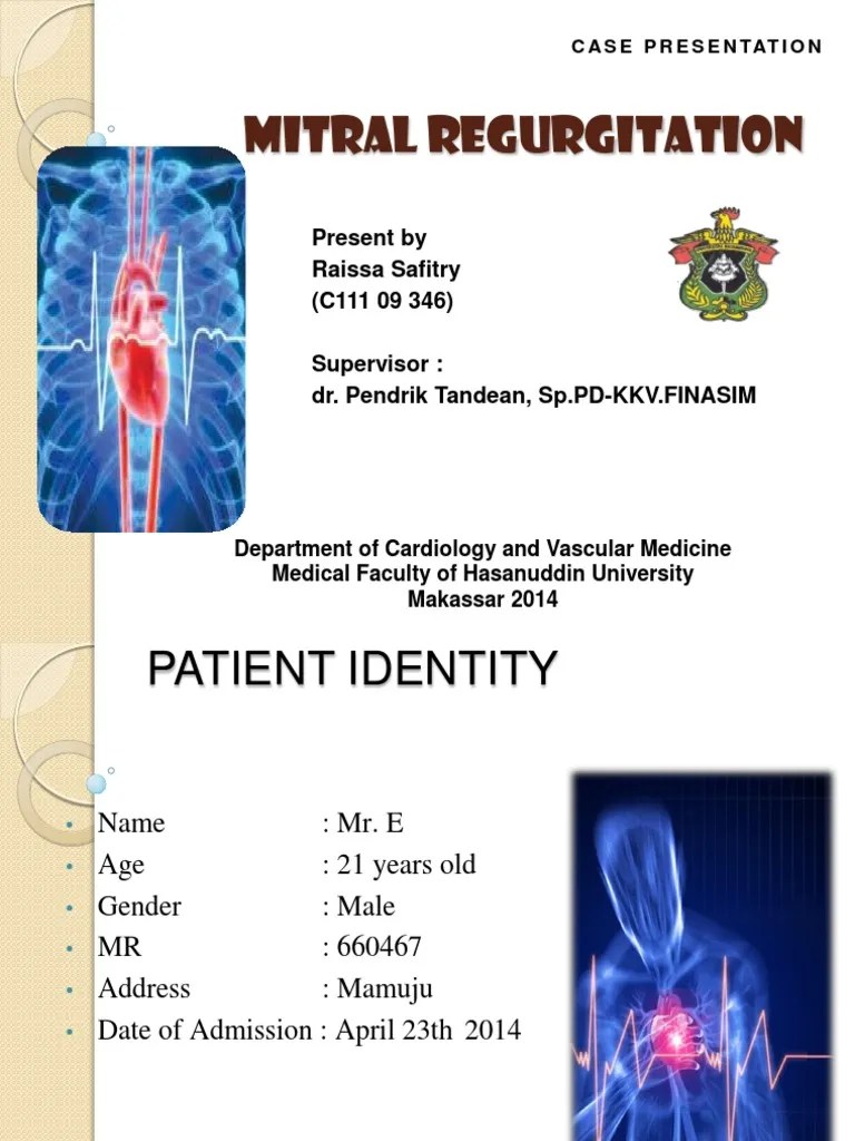 Mitral Regurgitation | PDF | Heart Failure | Heart Valve