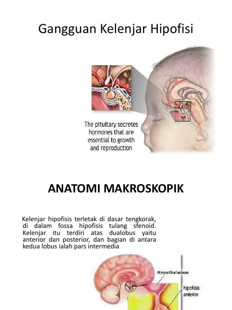Gangguan Kelenjar Hipofisi | PDF
