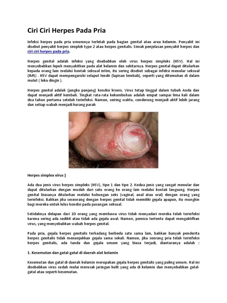 Ciri Ciri Herpes Pada Pria | PDF