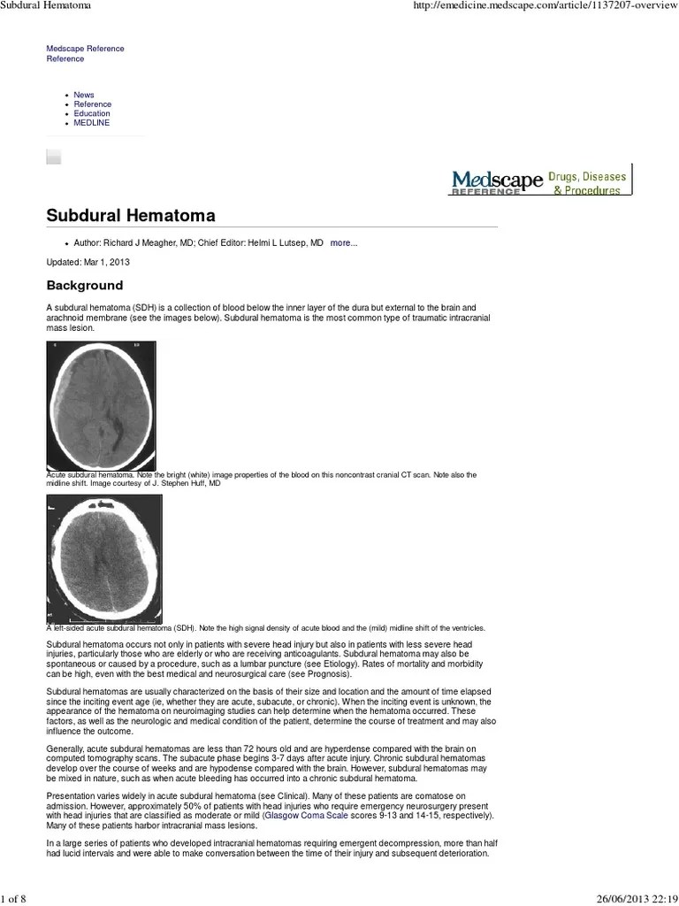 Subdural Hematoma | PDF | Traumatic Brain Injury | Neurology