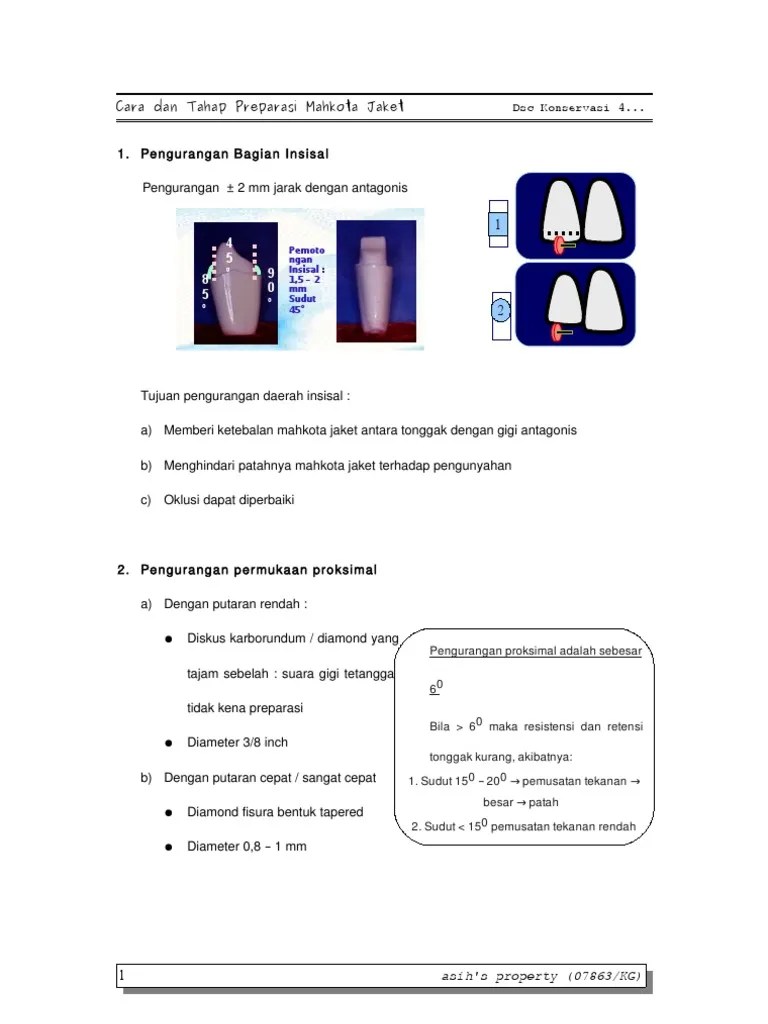 Cara Dan Tahap Preparasi Mahkota Jaket | PDF