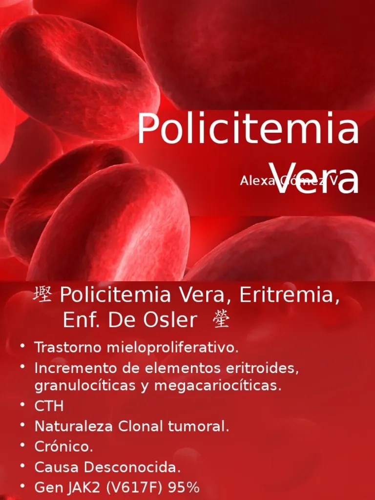 Policitemia Vera | Especialidades Medicas | Enfermedades y trastornos