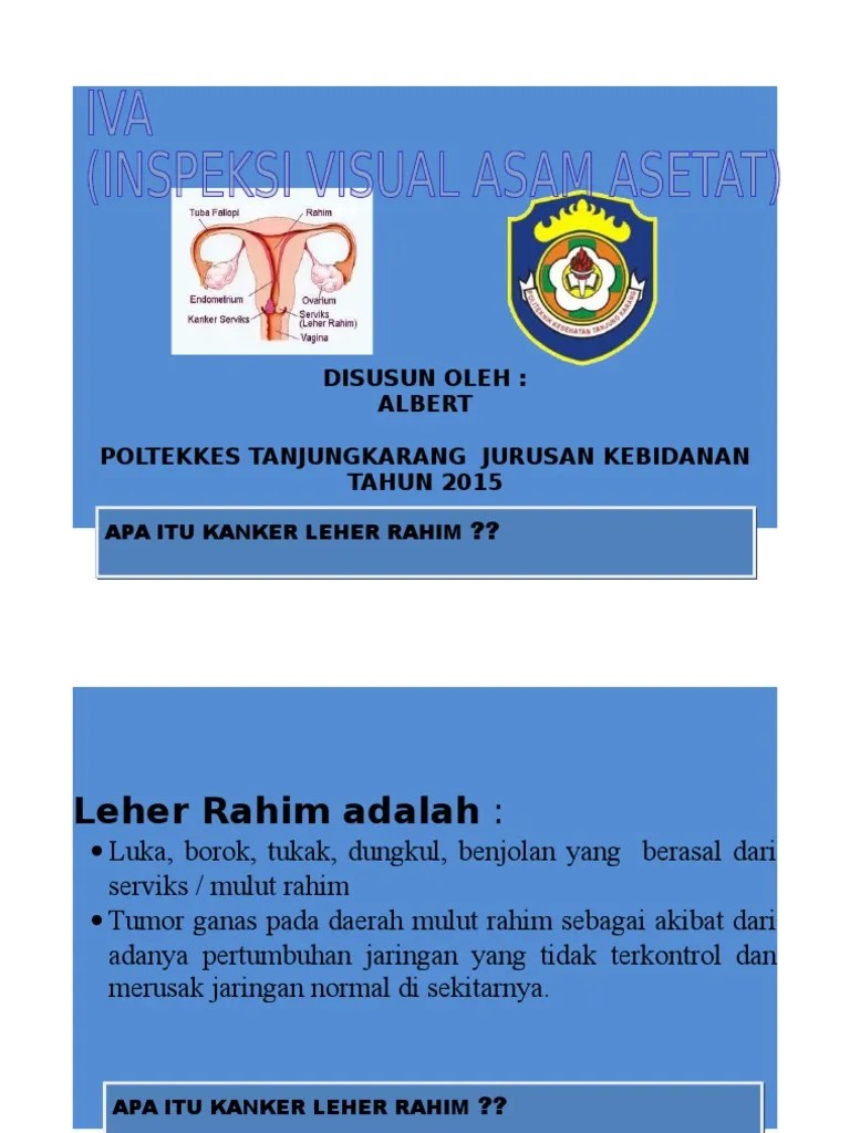 Government currently invests roughly $26 billion every year in funding for domestic hiv services and activit. Lembar Balik Iva