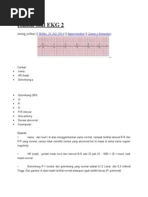 Jadi aktivitas listrik sesuai dengan jalur biasa (sa node). Contoh Soal Ekg 2 Pdf