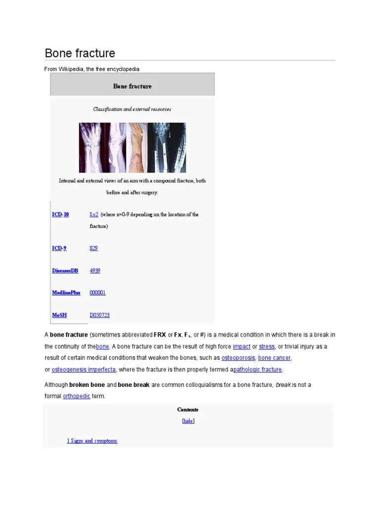 A Comprehensive Overview Of Bone Fracture Classification, Diagnosis ...