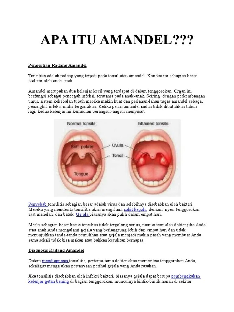 Apa Itu Amandel | PDF