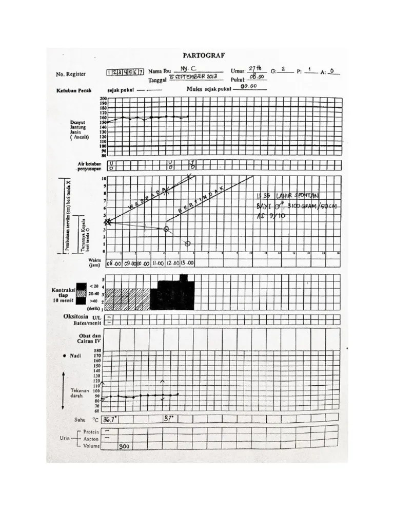 Lalu ada 15 orang siswa yang mengikuti kompetisi matematika, kemudian ada juga 13 orang. Contoh Soal Partograf Beserta Jawabannya