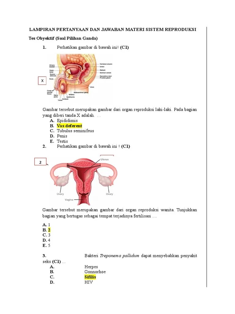 ођђsoalођѓ Hots Sistem ођђreproduksiођѓ ођђkelasођѓ ођђ11ођѓ