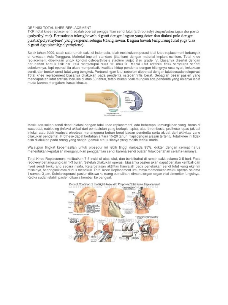 Manajemen Total Knee Replacement | PDF