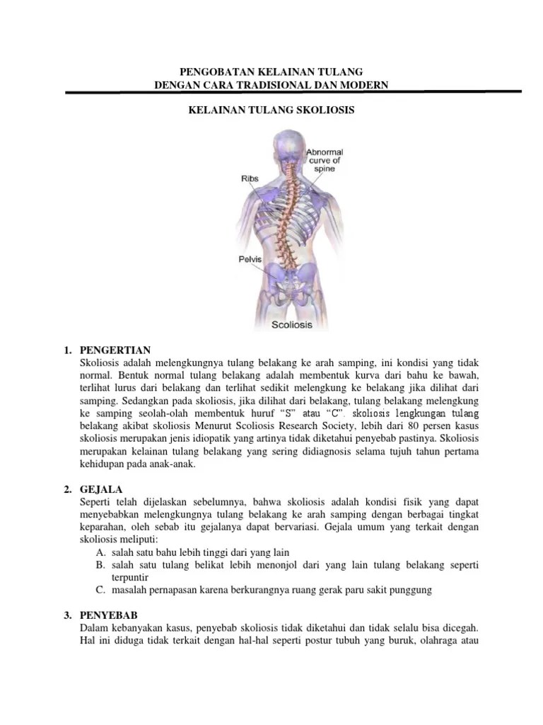 Skoliosis Adalah Salah Satu Bentuk Kelainan Pada Tulang - Seputar Bentuk