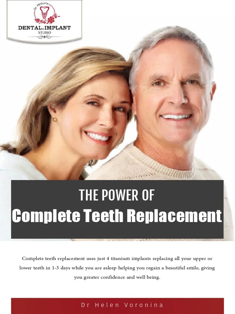 All On 4 Implants | PDF | Dental Implant | Dentistry