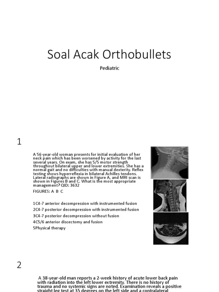 pic Dip Arthrodesis Orthobullets soal acak orthobullets 2019 back pain