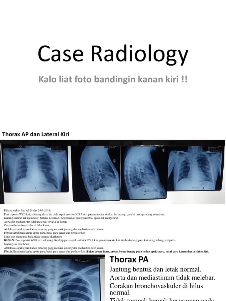 Case Radiology | PDF