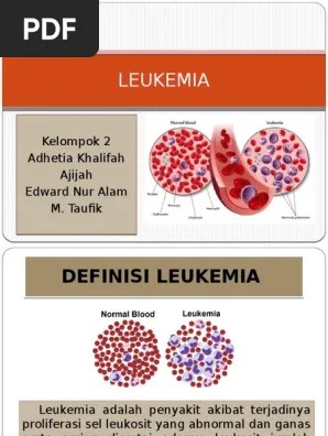 LEUKEMIA | PDF