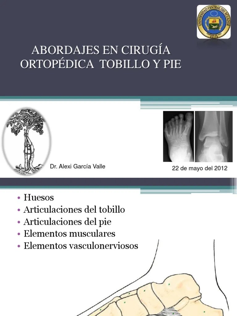 Abordajes De Tobillo Y Pie PDF | PDF | Tobillo | Dedo Del Pie