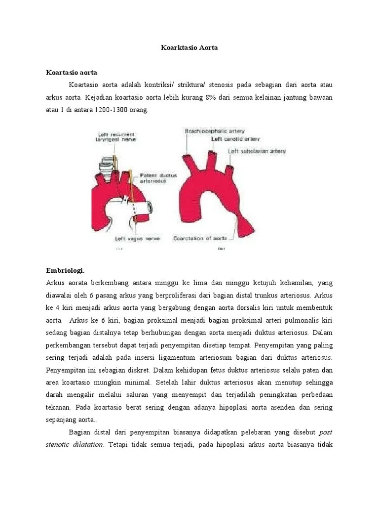 Koarktasio Aorta Tugas Interna | PDF