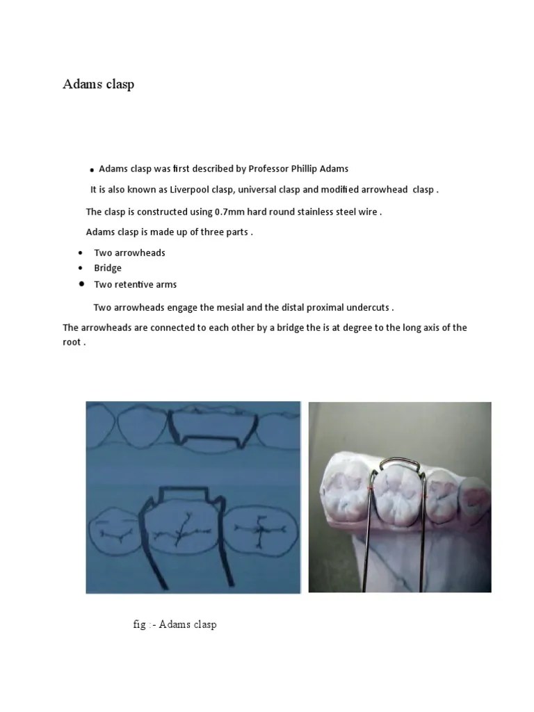 The Design And Fabrication Of Adams Clasp: A Step-by-Step Guide | PDF | Dentistry Branches | Mouth
