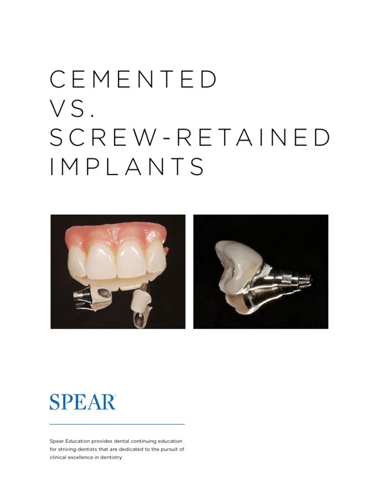 Spear's Cemented Vs. Screw-Retained Implants PDF | PDF | Dental Implant ...