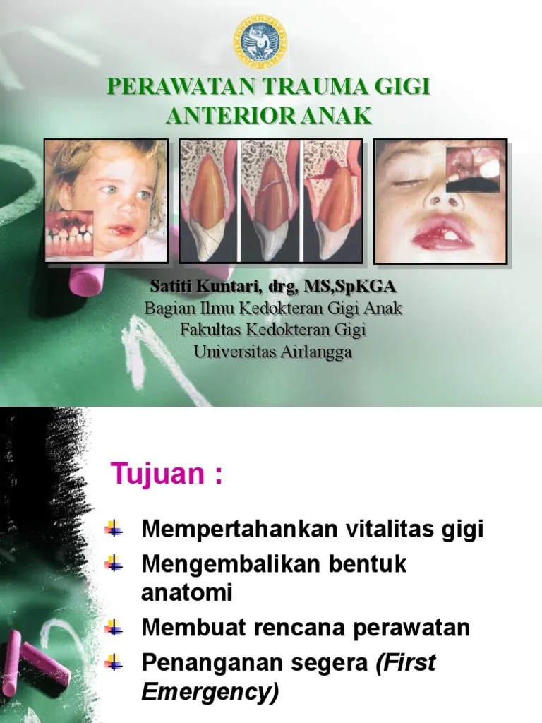 Perawatan Trauma Gigi Anterior Anak - 2 &amp; 16 Nov 2006 (DRG Sat | PDF