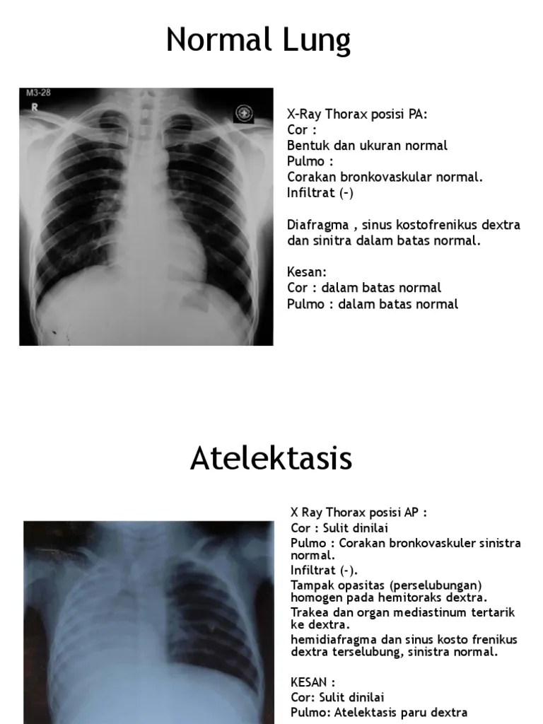 Catatan Radiologi | PDF