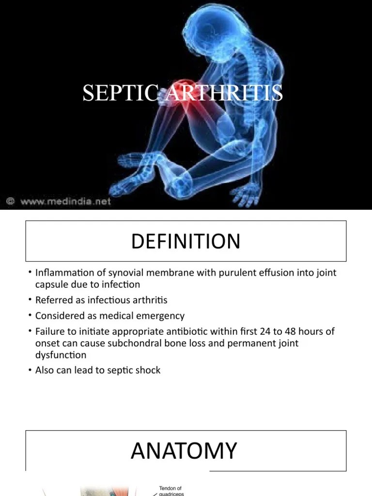 Septic Arthritis | PDF | Infection | Epidemiology
