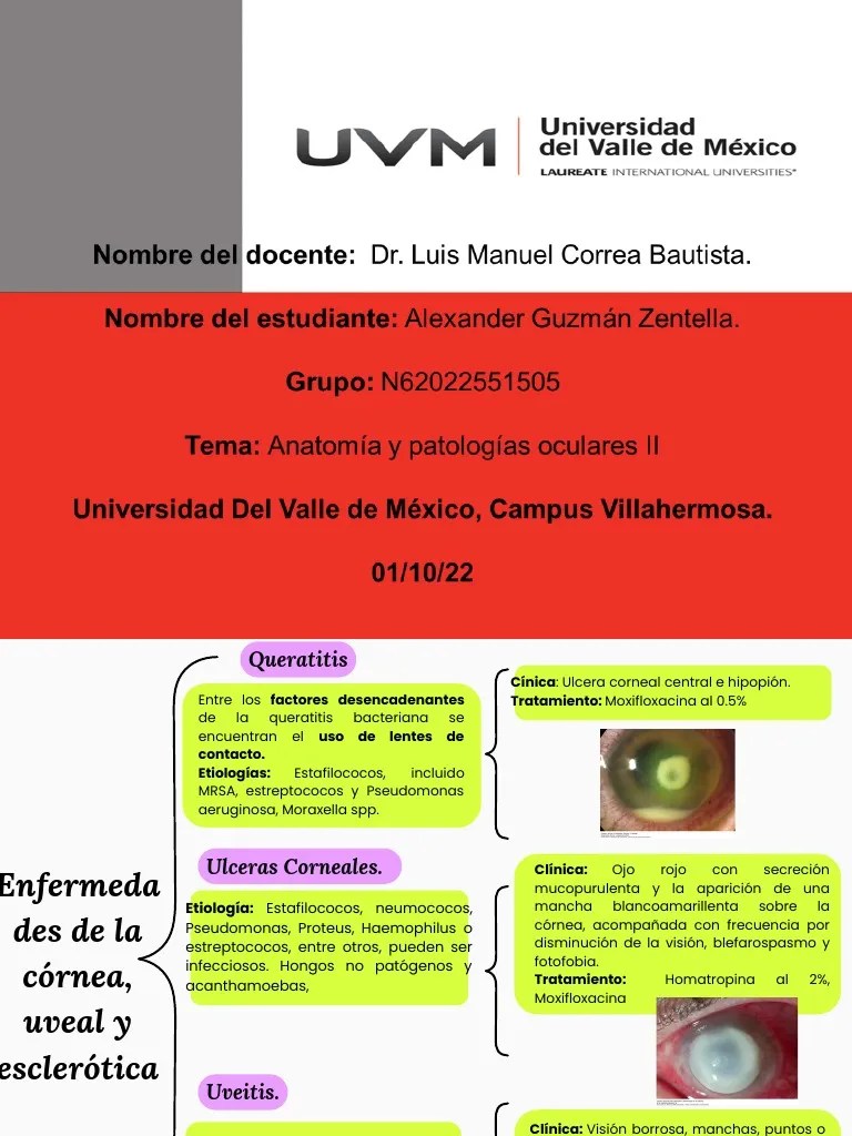 Anatomía Del Ojo Y Patologia Ocular | PDF | Ojo Humano | Glaucoma