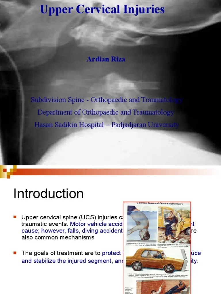 Trauma Cervical | PDF | Traumatology | Biomechanics