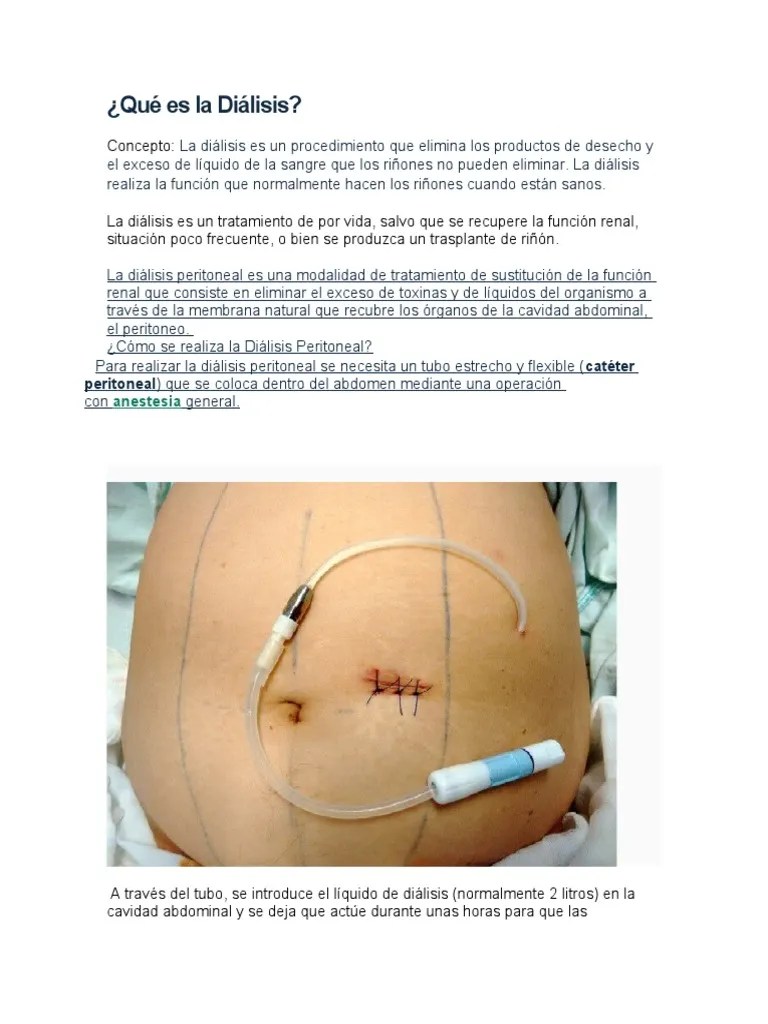 Dialisis Peritoneal | PDF | Peritoneo | Nefrología