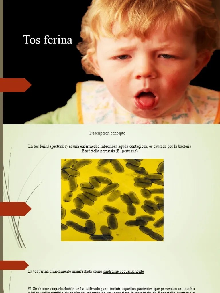 Tos Ferina | PDF | Enfermedades Y Trastornos | Epidemiología
