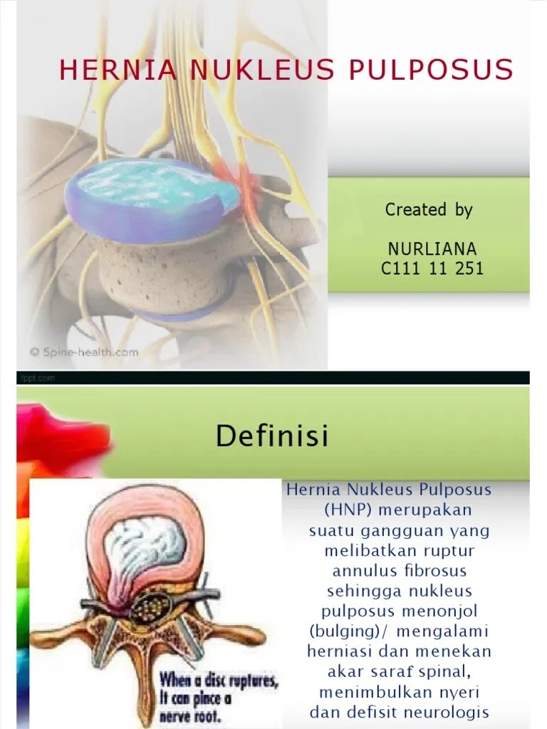 HNP-HERNIA | PDF