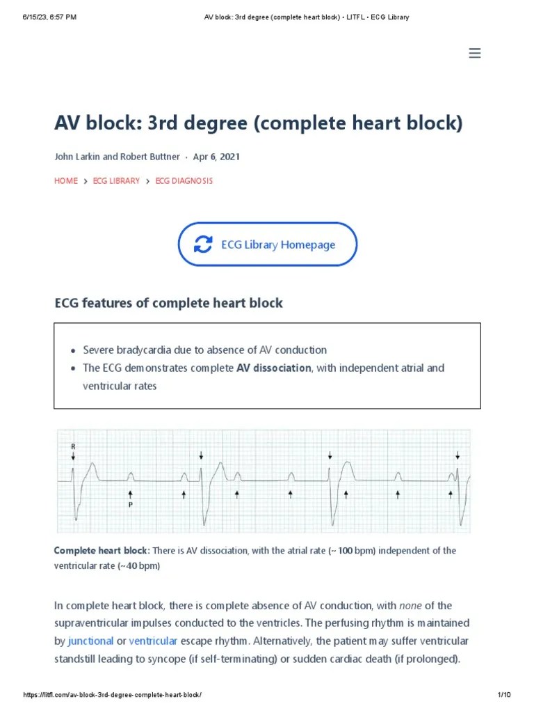 AV Block - 3rd Degree (Complete Heart Block) - LITFL - ECG Library | PDF