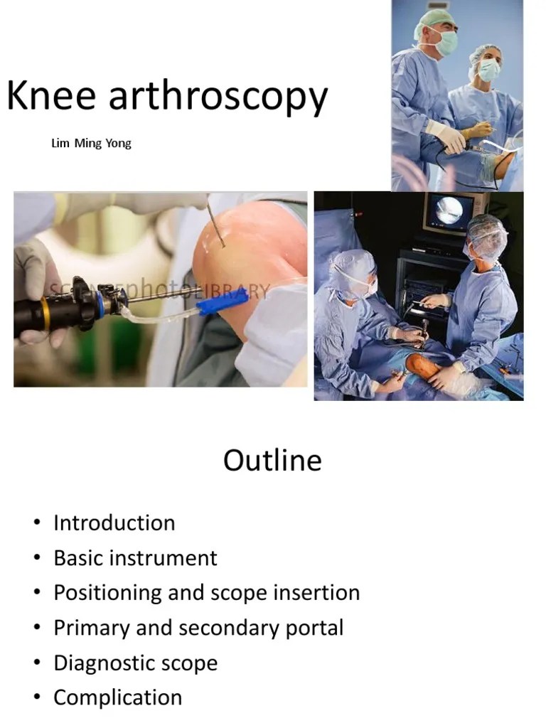 Knee Arthros | PDF | Knee | Musculoskeletal System