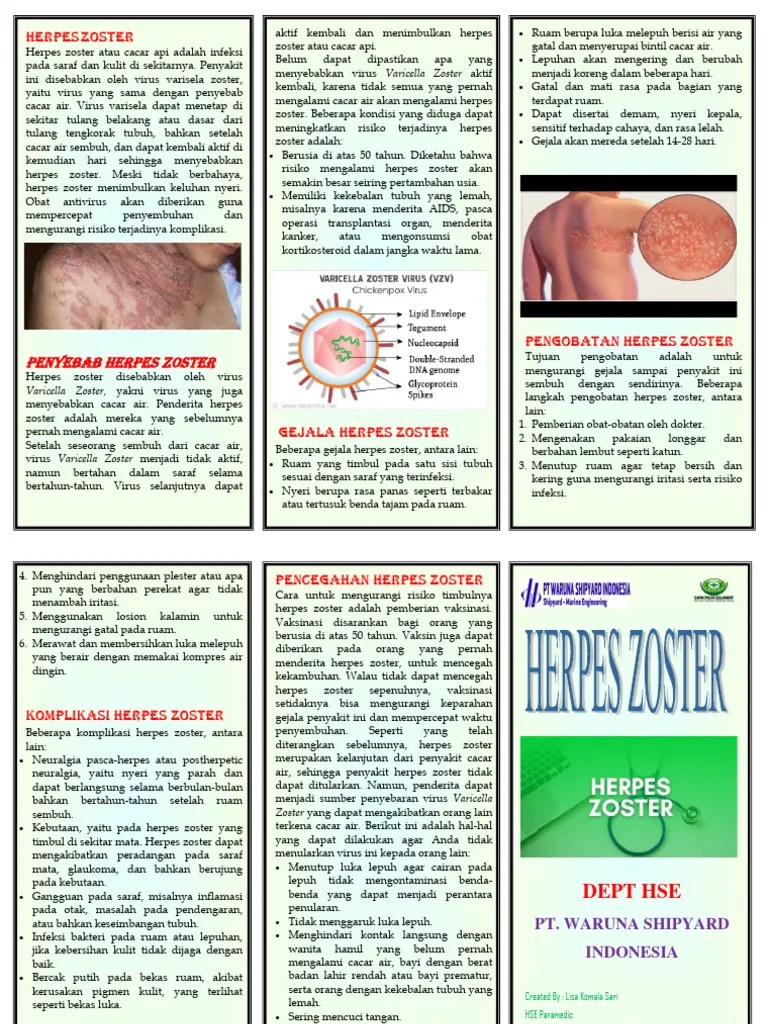 Herpes Zoster | PDF