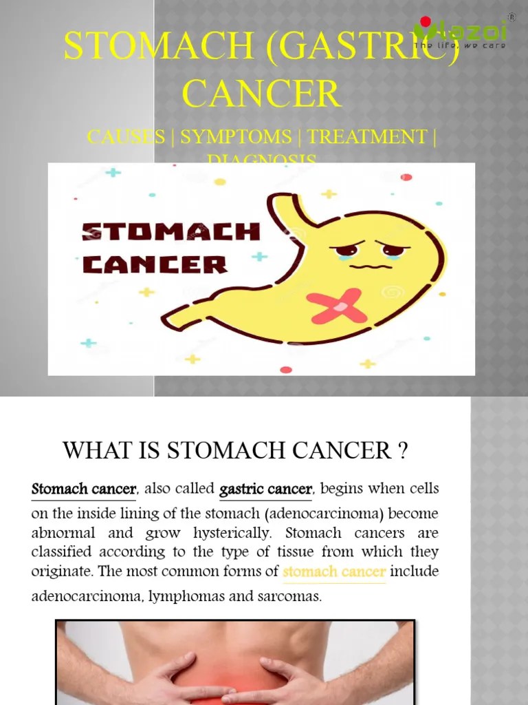 StomachGastricCancer | PDF | Cancer | Gastroenterology