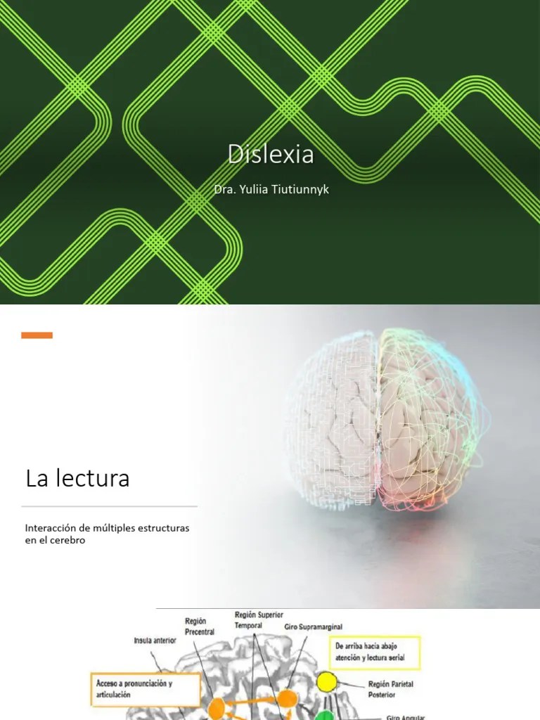 Dislexia | PDF | Comprensión Lectora | Aprendizaje