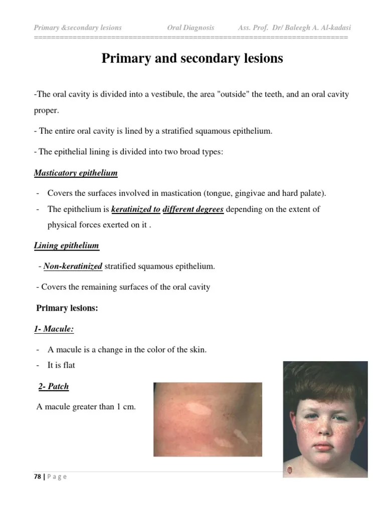 7primary & Secondary Lesions | PDF | Epithelium | Dermatology