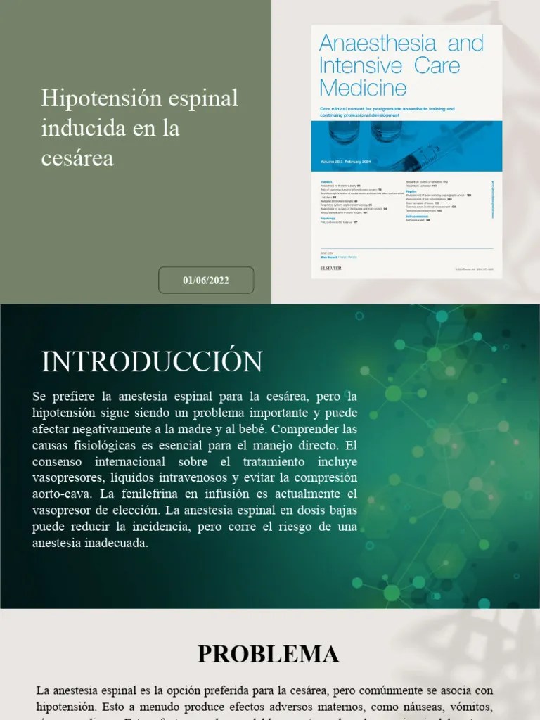 Spinal-Induced Hypotension At Caesarean Section | PDF | Parto | Cuidado De La Salud