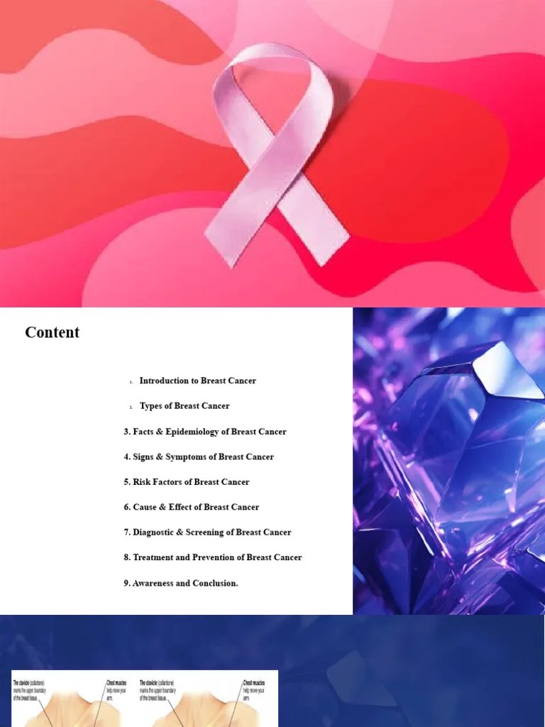 Breast Cancer | PDF | Breast Cancer | Cancer