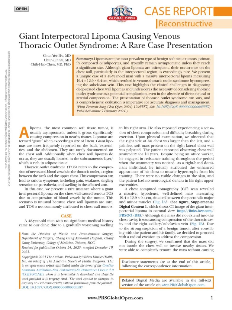 Giant Interpectoral Lipoma Causing Venous Thoracic.31 | PDF | Medical Specialties | Anatomy