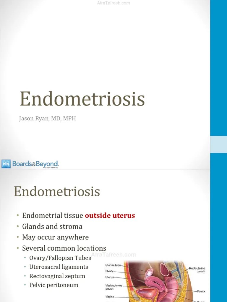 Endometriosis Atf | PDF | Menstrual Cycle | Ovary