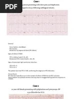ECG - EKG Practice Quiz (Identify Rhythms) | PDF | Electrocardiography ...