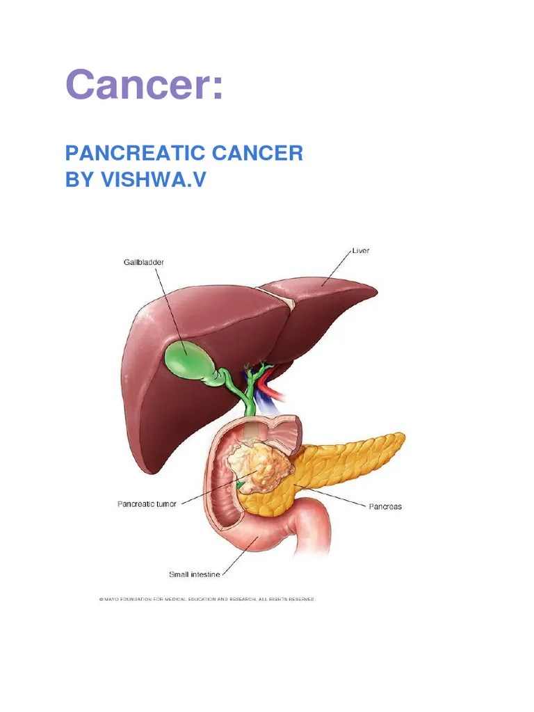 PANCREATIC Cancer | PDF | Pancreas | Pancreatic Cancer