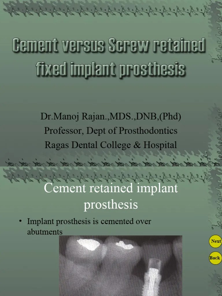 Cement Versus Screw Retained Implant Prostheses | PDF | Dental Implant | Medical Specialties