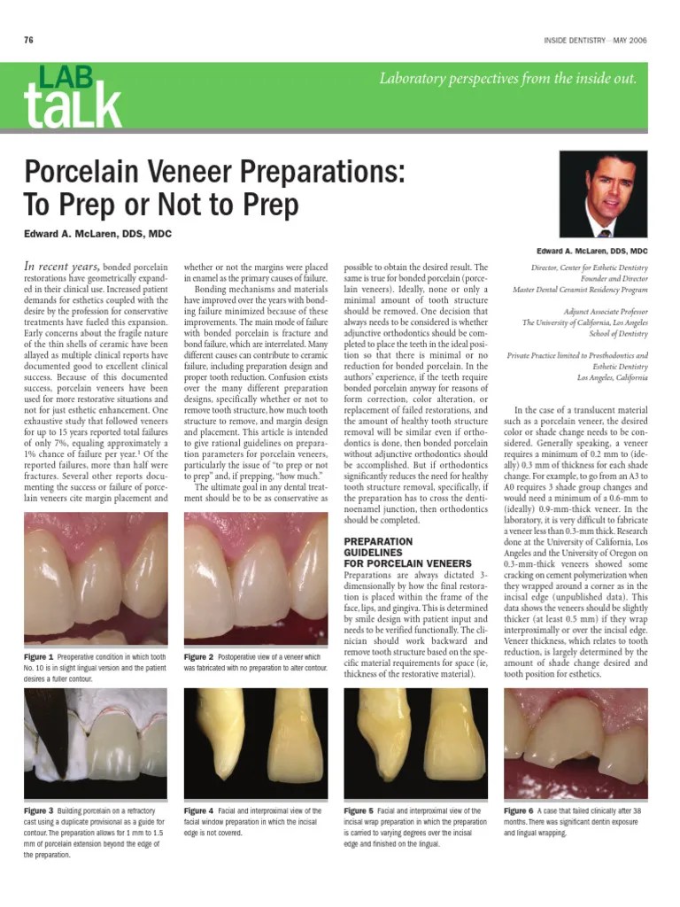 Porcelain Veneer Preparations | PDF | Young's Modulus | Tooth Enamel