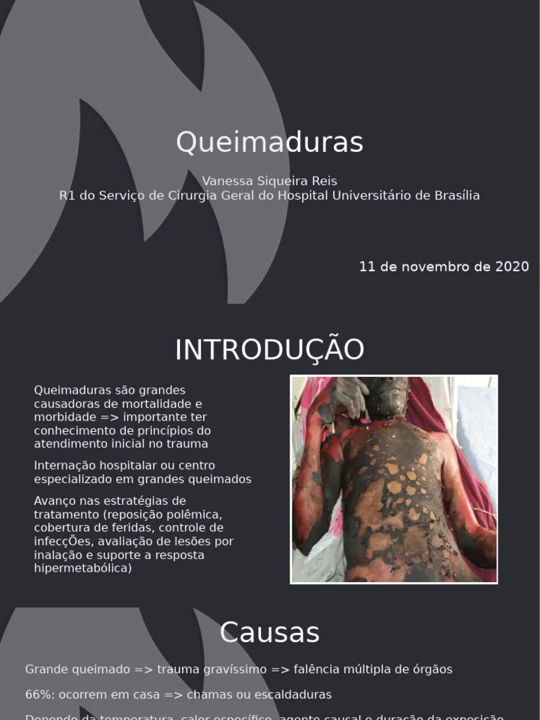 Tratamento Queimaduras | PDF