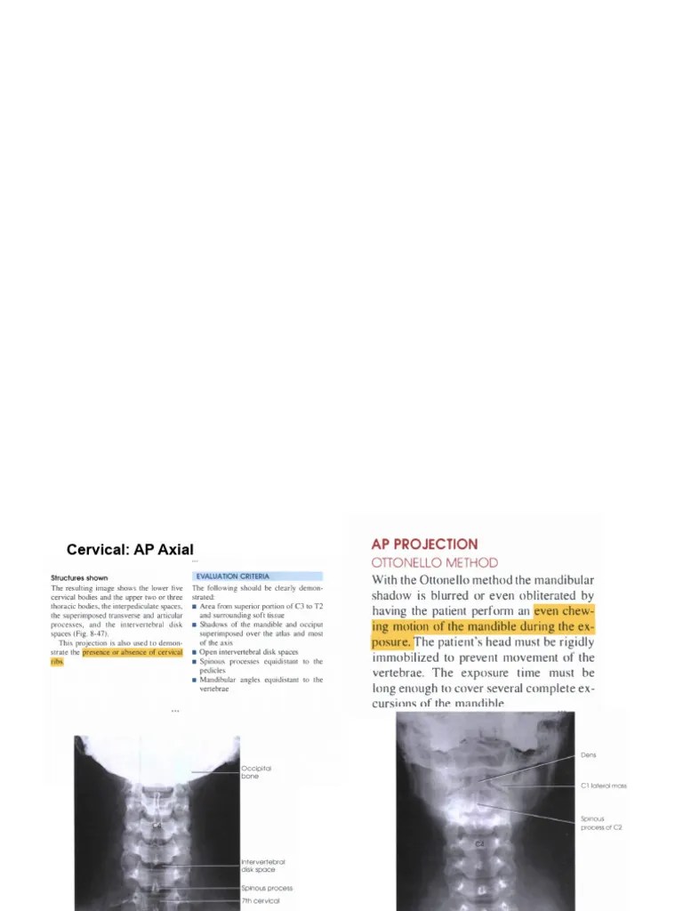 VERTEBRAL COLUMN | PDF
