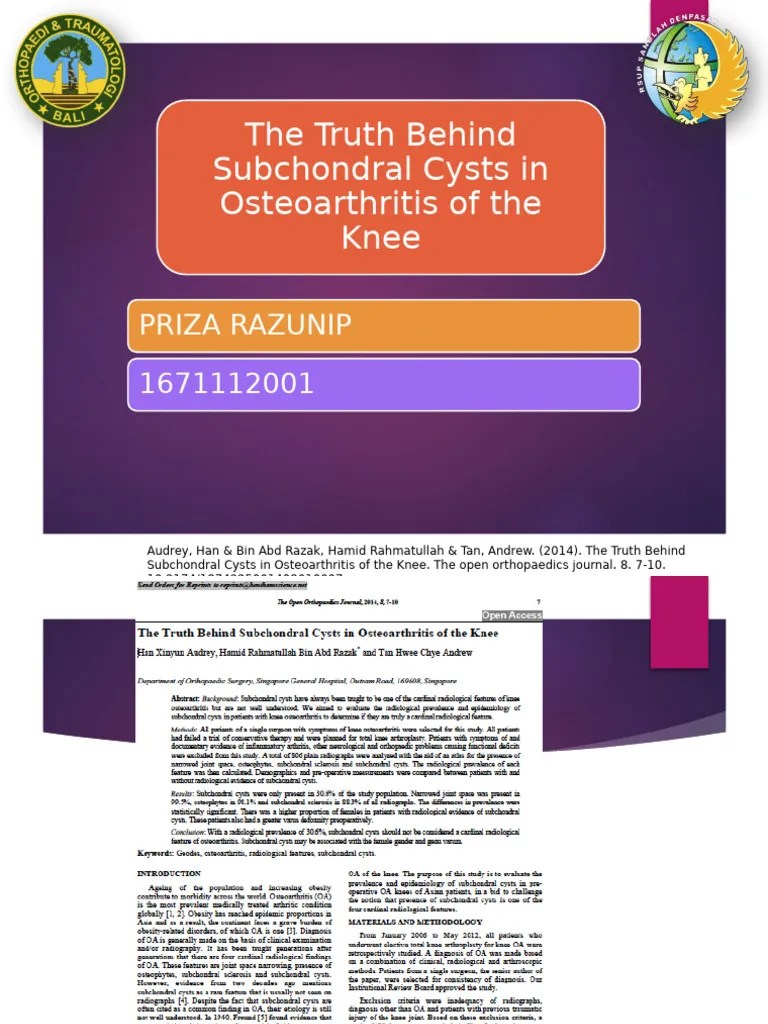 Osteoarthritis Knee | PDF | Osteoarthritis | Knee