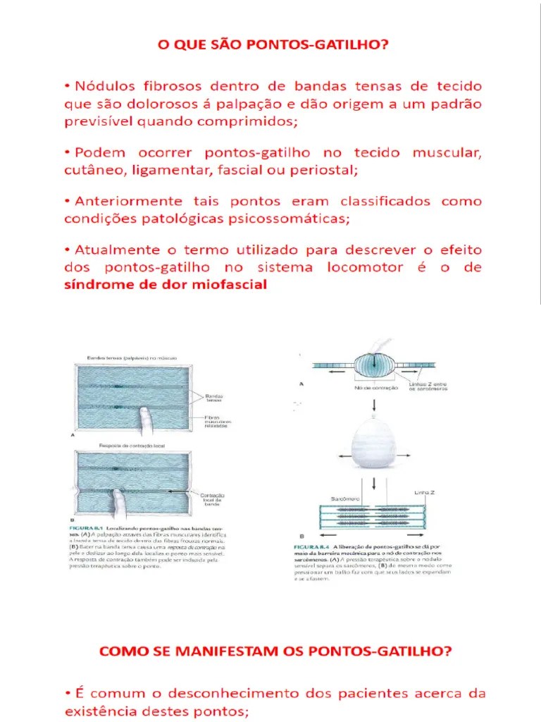 7_-_Pontos_gatilho | PDF