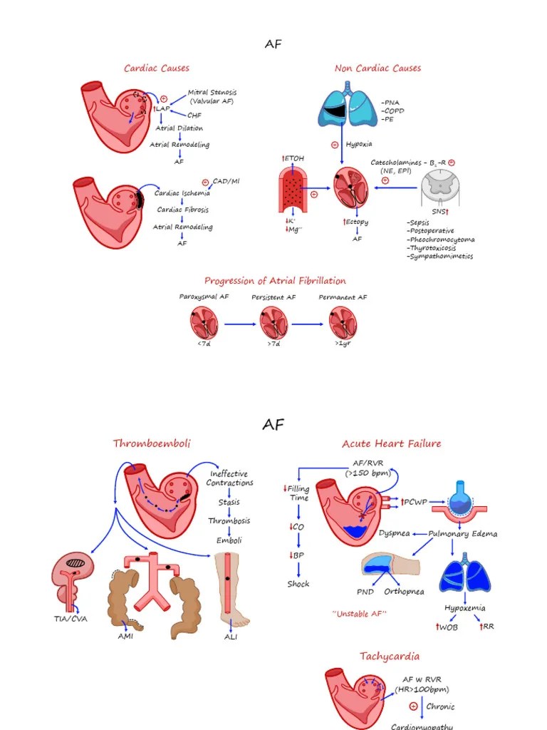 Atrial Fibrillation | PDF | Heart | Heart Failure