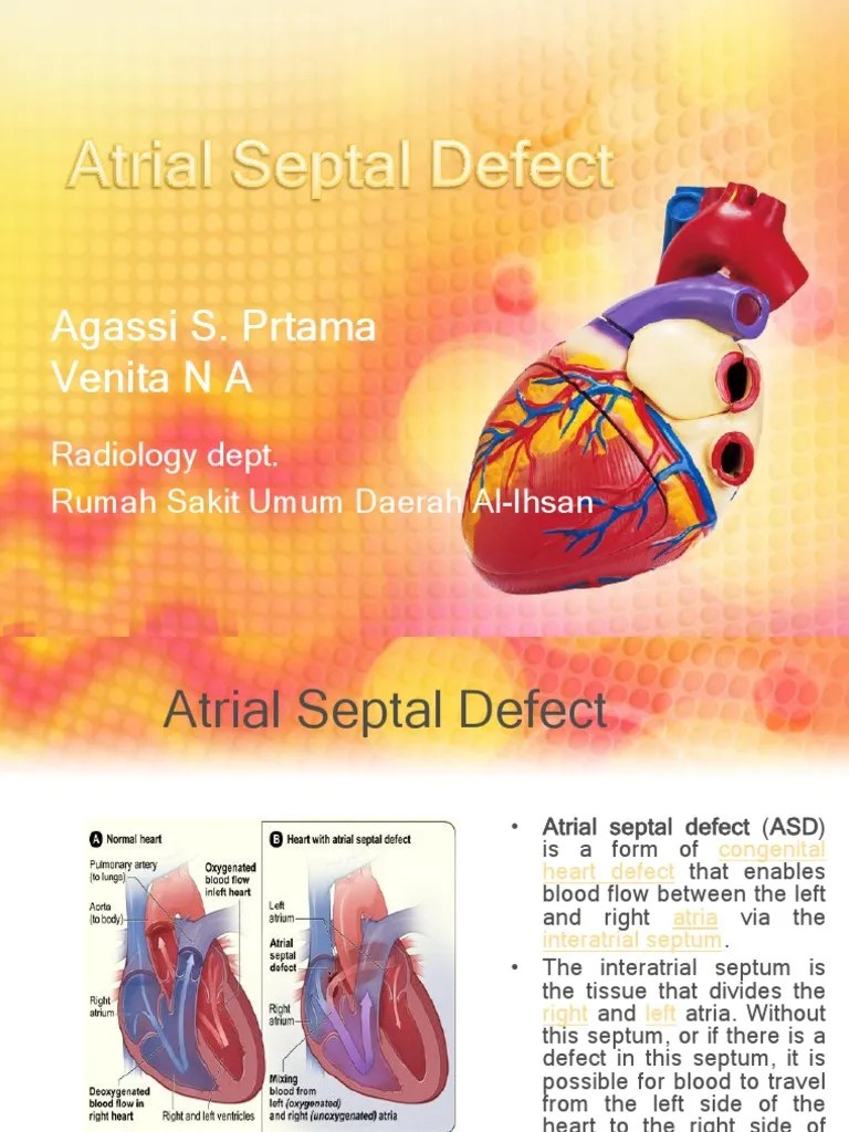 Atrial Septal Defect | Download Free PDF | Atrium (Heart) | Heart